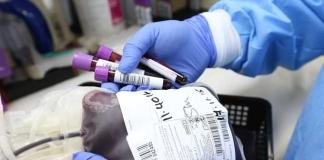 189 рублей и оплачиваемый выходной: как стать донором крови в Могилёве